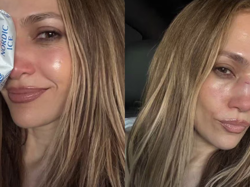 Jennifer Lopez after the fall